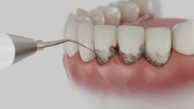 Reliable Dental Implants contractor in McGregor, TX by Smile Center Dentistry